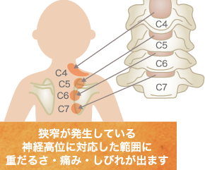 スマートフォンを見る悪い姿勢が首に負担をかけているイラスト