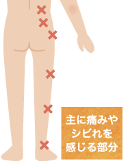 腰から足にかけて痛みを感じ、歩行が困難な様子のイラスト