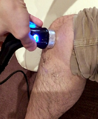 鵞足炎への超音波治療の様子