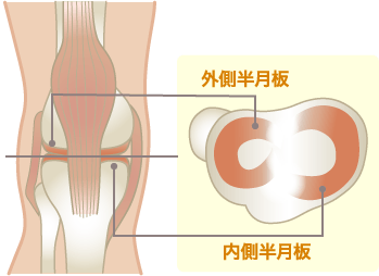 半月板損傷のメカニズム図解
