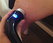 半月板損傷への超音波治療の様子