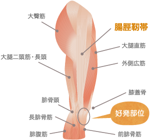 腸脛靭帯の関連筋肉図