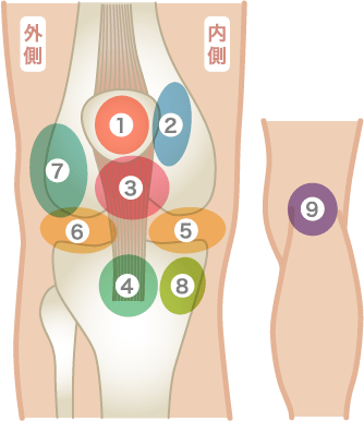 膝の痛みの部位を図解