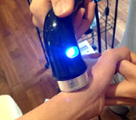 ドケルバン病への鍼治療