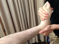 リスフラン関節捻挫後のリハビリサポート