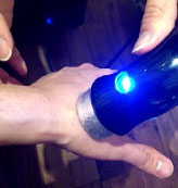 手指の関節症へのアプローチ