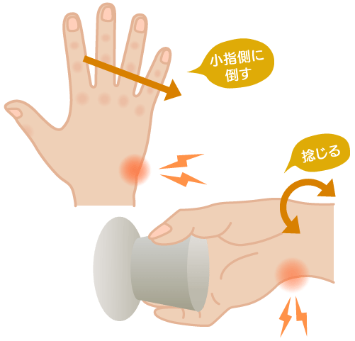 TFCC損傷の痛みを誘発する動作