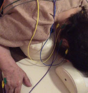 突発性難聴の専門鍼治療を行う様子