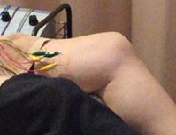 宇和島市・西予市で足のしびれ・坐骨神経痛に行う専門施術