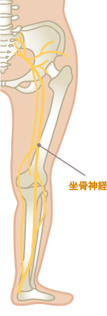 坐骨神経痛によるお尻から足への痛み・しびれの症状範囲