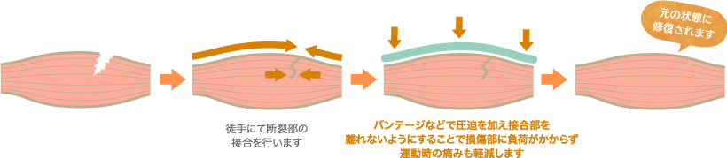 当院での肉ばなれの治療