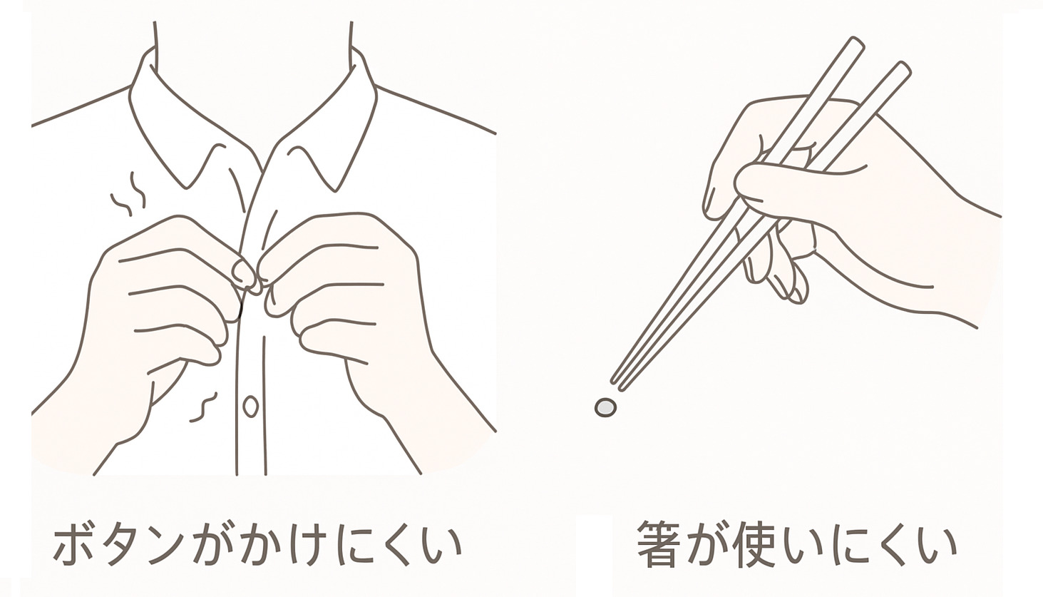 後縦靭帯骨化症の代表的な症状である巧緻運動障害（ボタンがけ・箸の使用）のイラスト