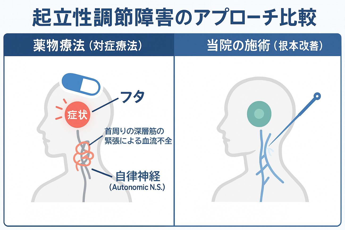 起立性調節障害の治療比較：薬物療法が症状に蓋をするのに対し、当院の施術が自律神経という根本原因を改善する様子の図解