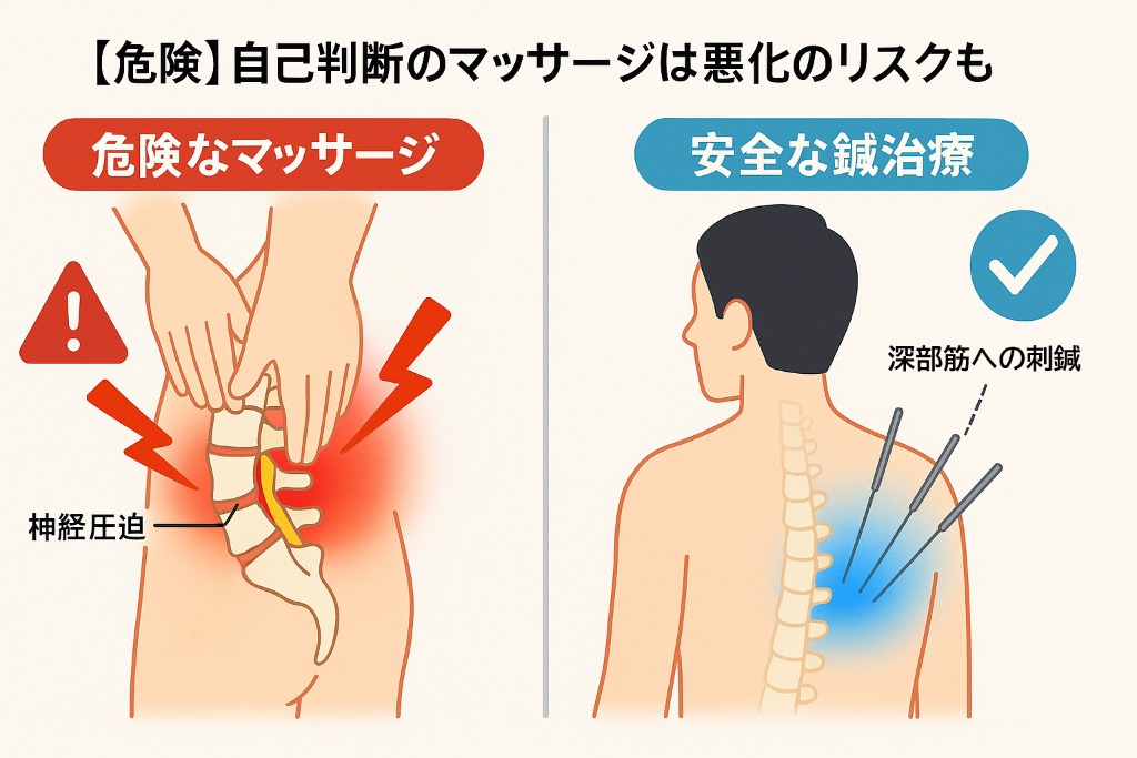 腰椎椎間板ヘルニアに対して危険なマッサージと安全な鍼治療の比較図
