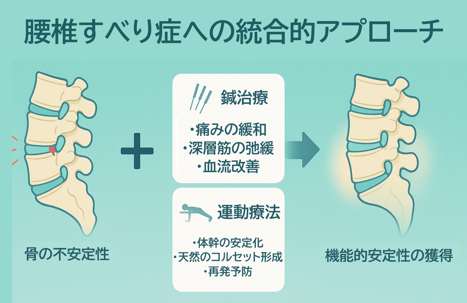 腰椎変性すべり症に対する鍼灸と運動療法を組み合わせた統合的アプローチの解説図。鍼治療で痛みや血流を改善し、運動療法で体幹を安定させ、「機能的安定性」を獲得して根本改善を目指す流れを示しています。